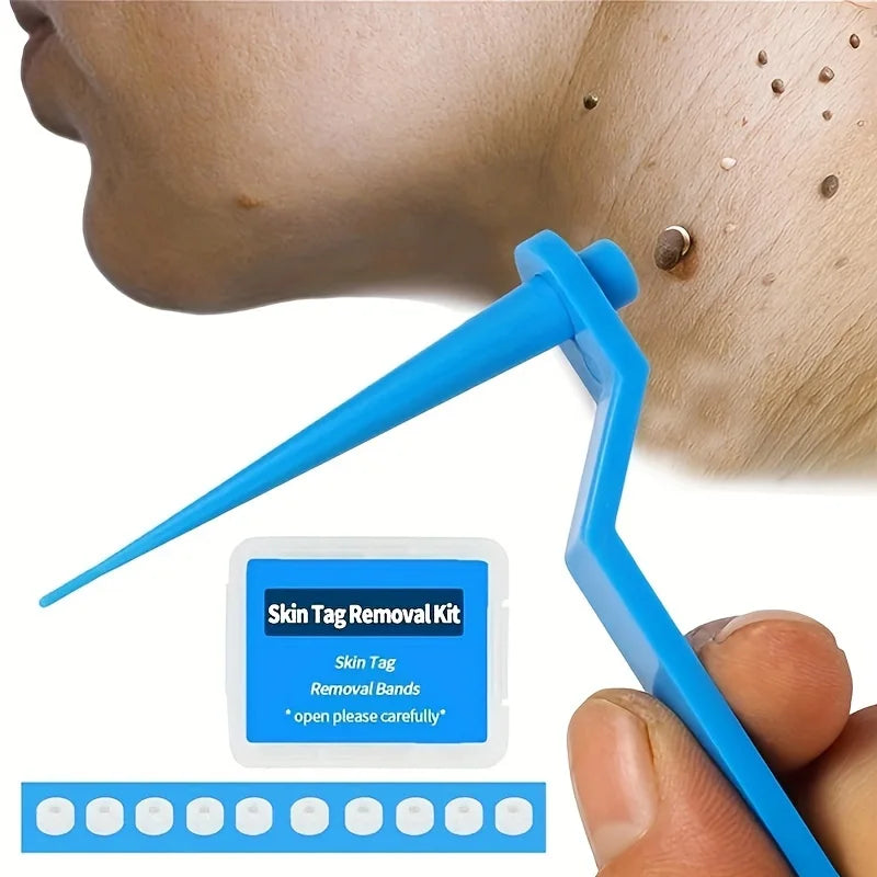 DermaClear™ Skin Tag Removal Kit