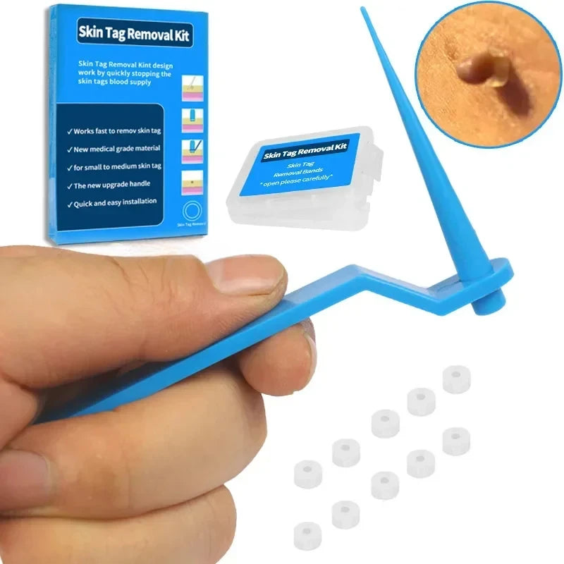 DermaClear™ Skin Tag Removal Kit