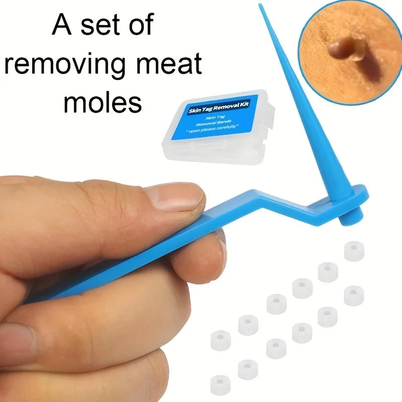 DermaClear™ Skin Tag Removal Kit