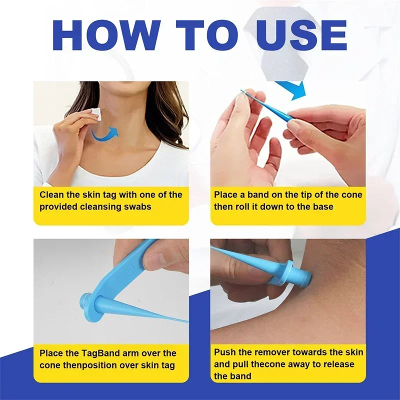 DermaClear™ Skin Tag Removal Kit